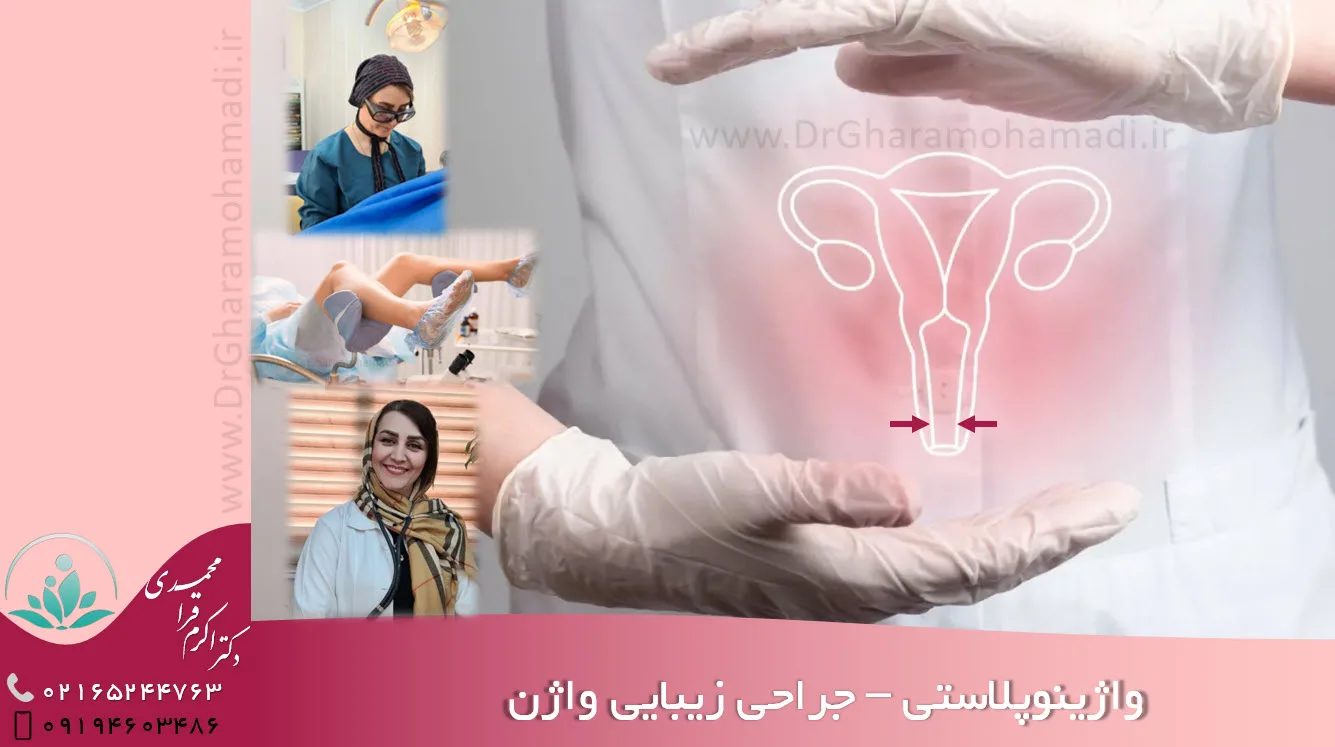 واژینوپلاستی در شهریار - جراحی زیبایی واژن در شهریار